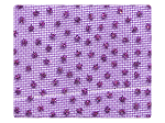 305 Purple Mesh